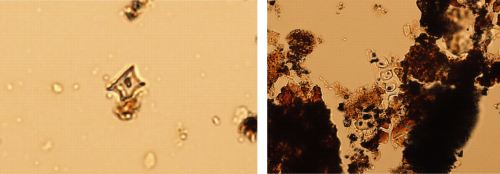 Microscopic analyses of pottery residues can reveal fragments of foods. The image at left is a phytolith of maize or corn while the image at right is of a variety of grasses and shrubs (images courtesy of Andrew Lints).